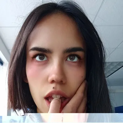 Alesoal